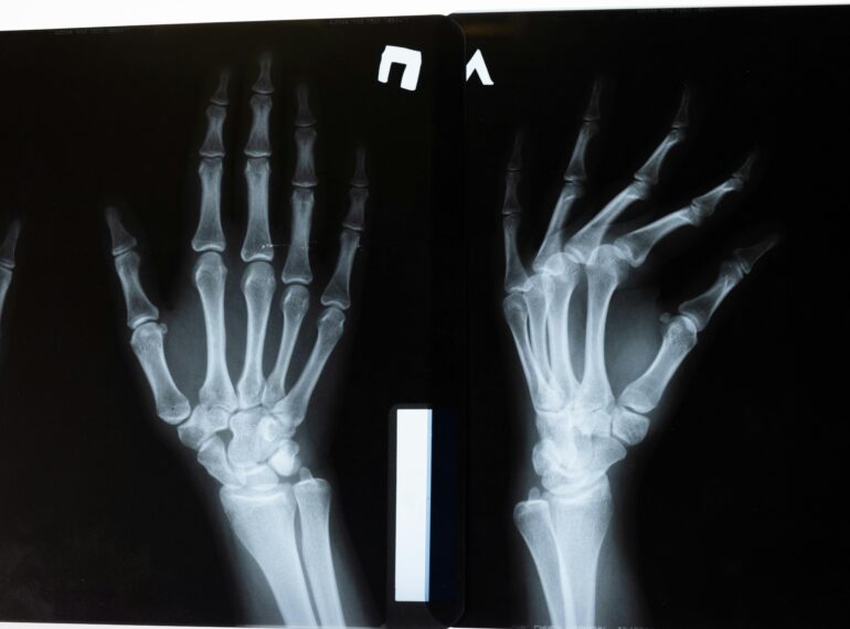 High-resolution x-ray image showing the intricate anatomy of human hands.