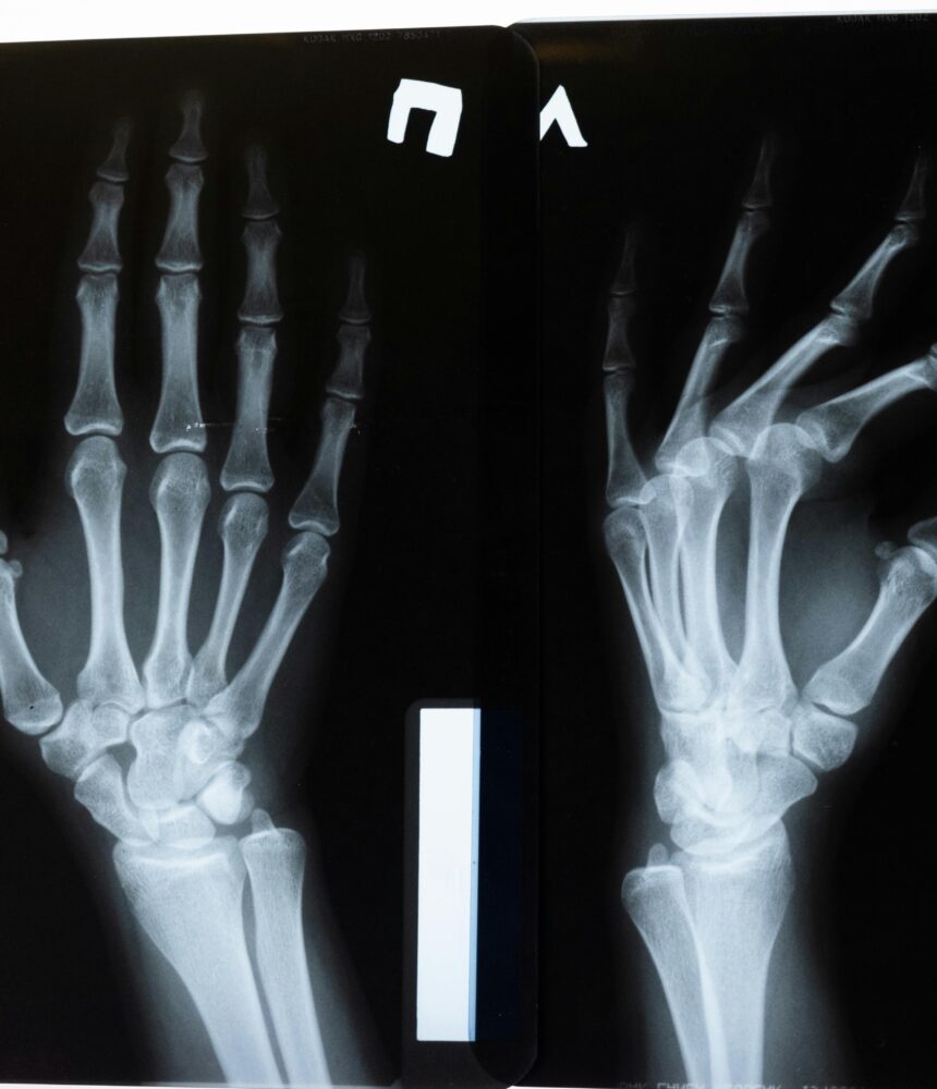 High-resolution x-ray image showing the intricate anatomy of human hands.