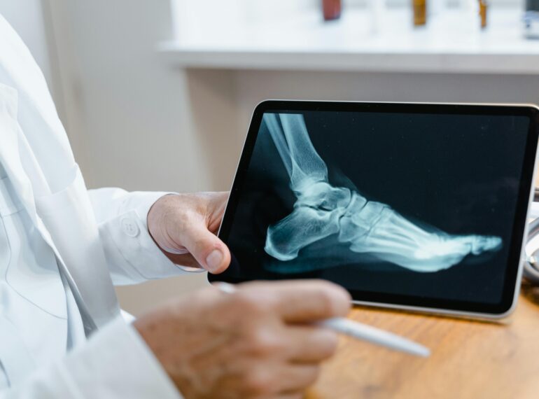 Doctor examining a foot X-ray image on a digital tablet using a stylus in a medical office.