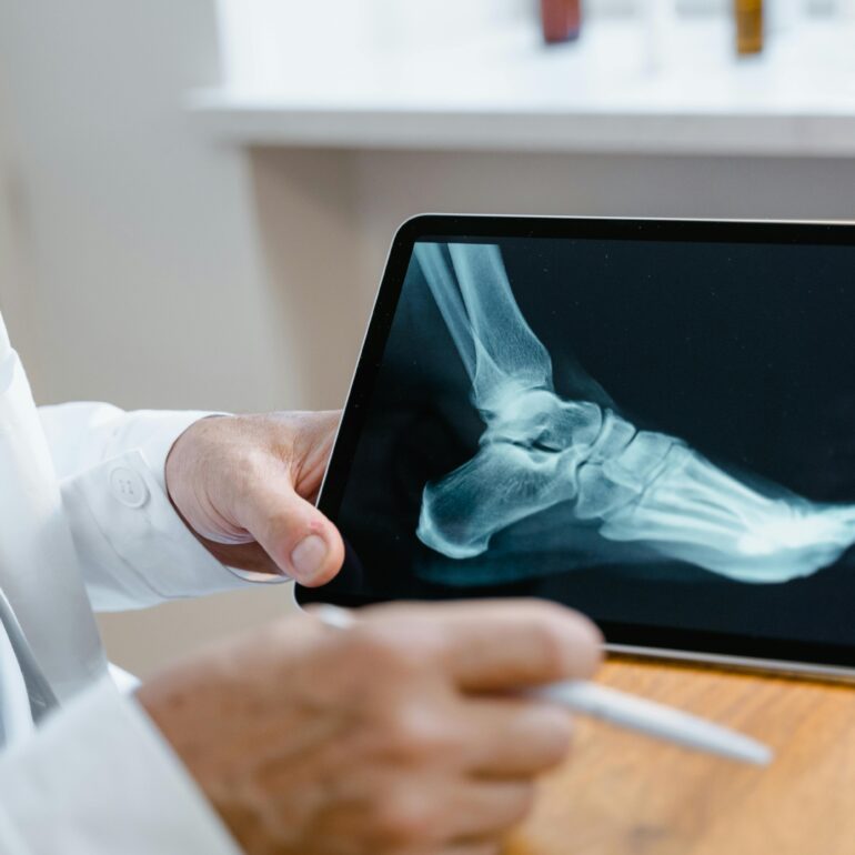 Doctor examining a foot X-ray image on a digital tablet using a stylus in a medical office.